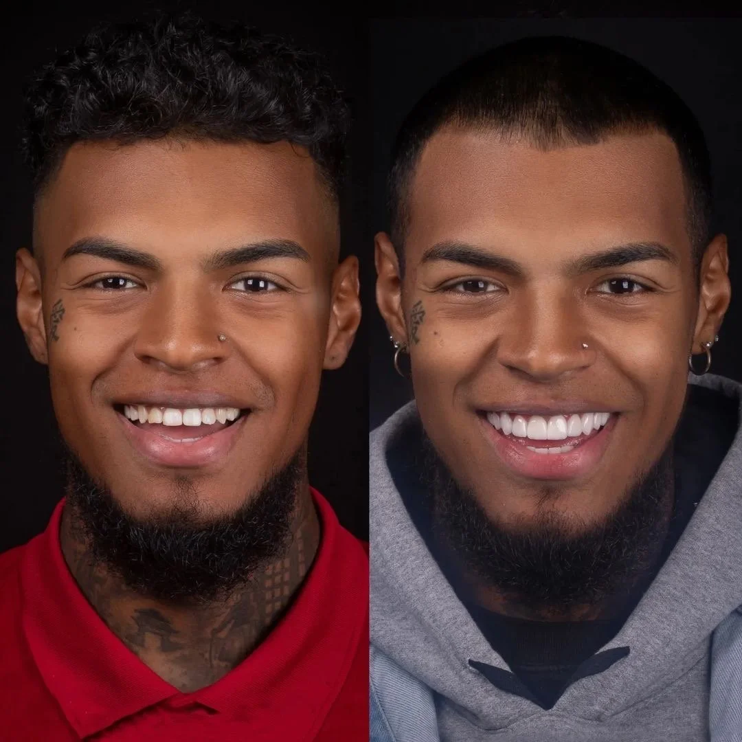 Antes e depois: transformação com essência.